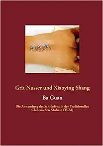 Ba Guan: Die Anwendung des Schröpfens in der Traditionellen Chinesischen Medizin (TCM)