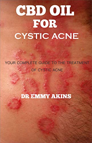 CBD Oil for Cystic Acne: Your Complete guide to the Treatment of Cystic Acne