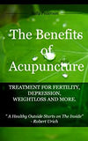 The Benefits of Acupuncture